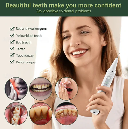 Dentora | Professioneller Ultraschall-Zahnsteinentferner für effektive Zahnpflege zu Hause - Image 2