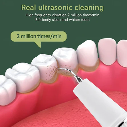 Dentora | Professioneller Ultraschall-Zahnsteinentferner für effektive Zahnpflege zu Hause - Image 4