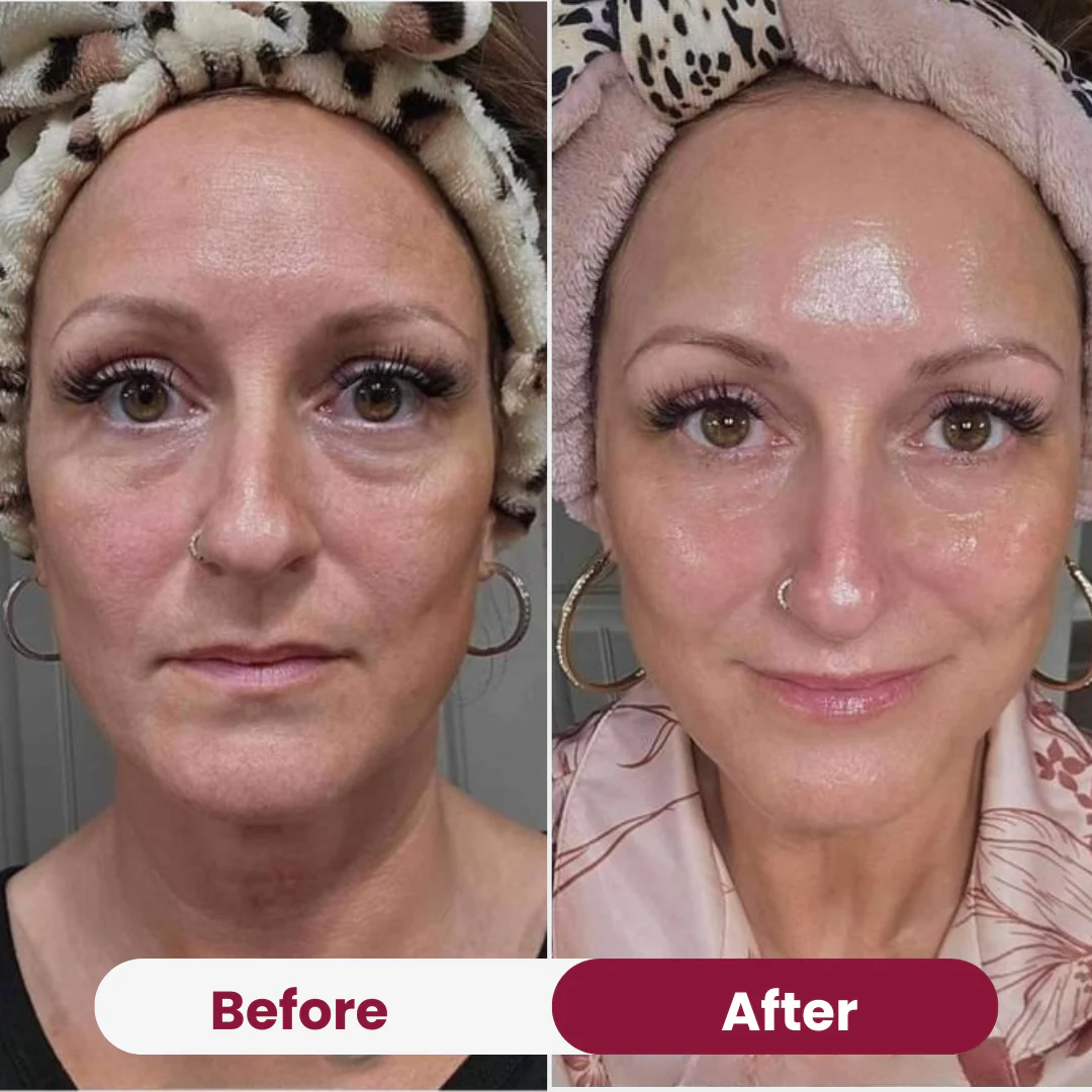 GlanzMaske™ Jugendliche Haut Maske - Image 4