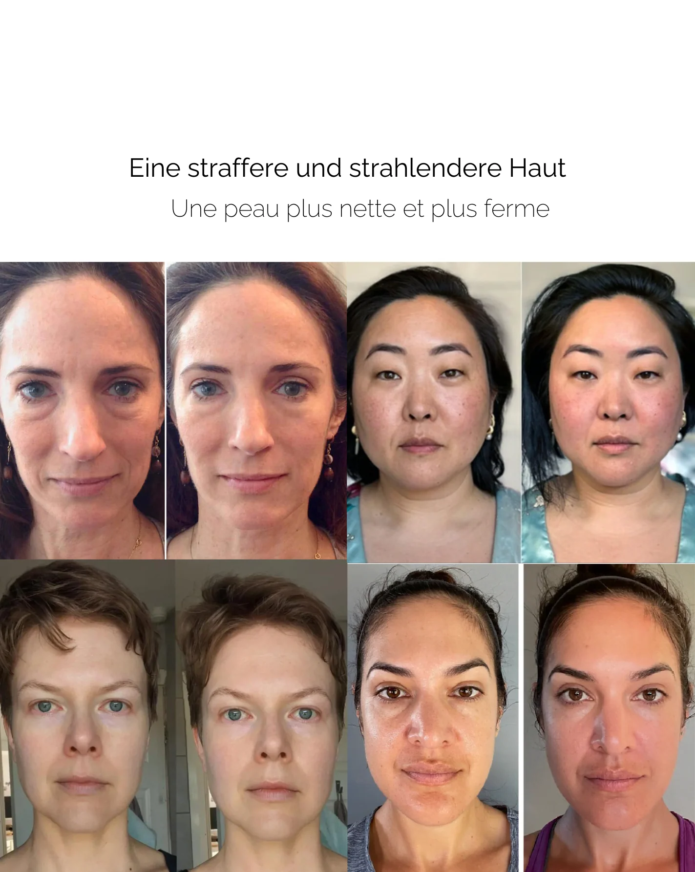 GlanzRolle™ Sanfte Hauterneuerung - Image 6