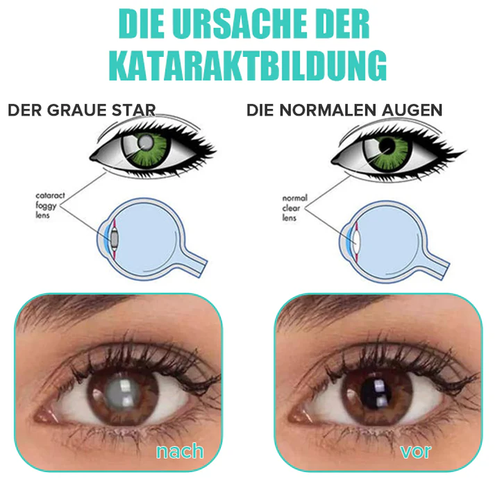 KlarTropfen™ Rötung Schnell Lindern - Image 11